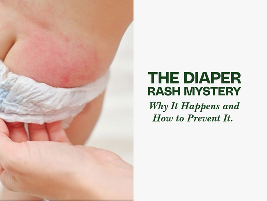 The Diaper Rash Mystery: Why It Happens and How to Prevent It